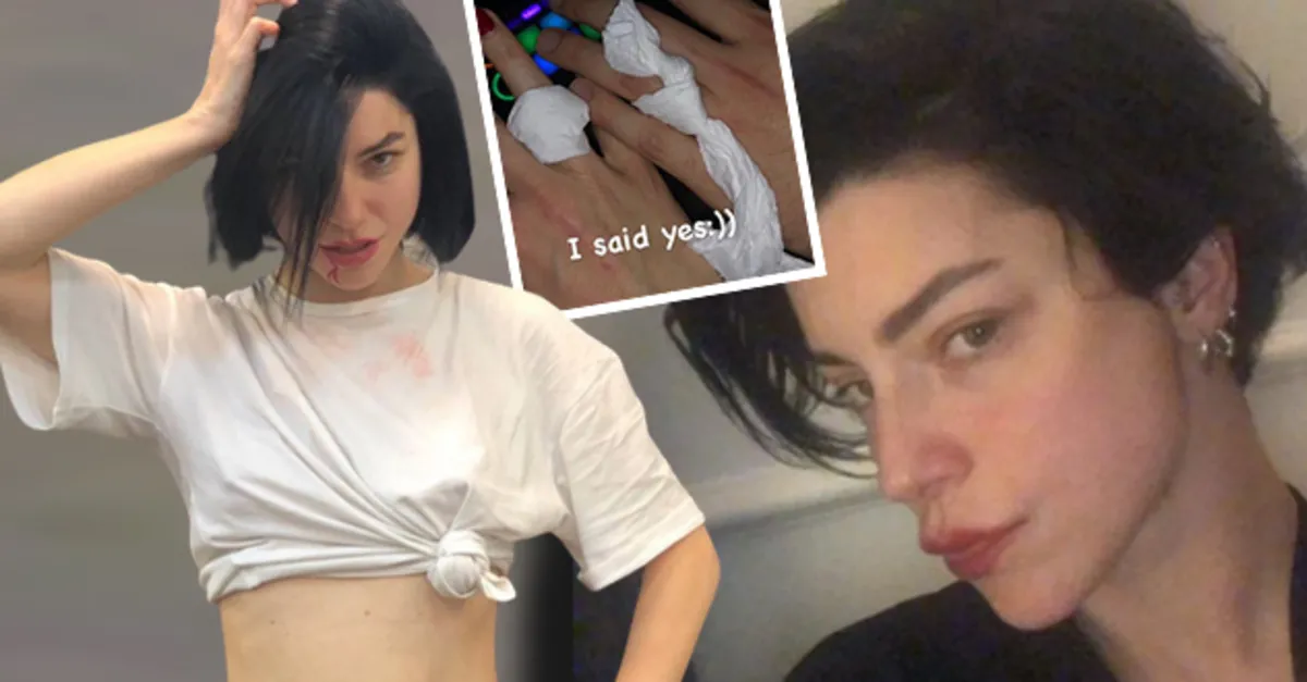 Merve Boluğur ’I said yes’ paylaşımıyla ağızları açık bıraktı! ’Dönüyorum’ dedi paylaşımlarıyla sosyal medyayı salladı: Yeniden mi evleniyor?