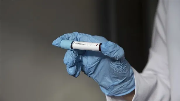 Kovid-19 testinde yeni dönem! Fransa’da cep telefonuyla yapılan koronavirüs testi geliştirildi-2