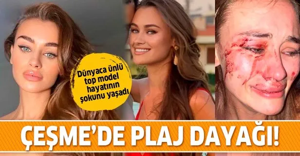 Son dakika: Dünyaca ünlü top model Daria Kyryliuk’a plajda dayak