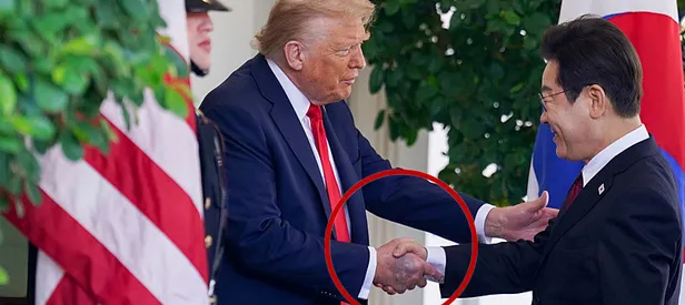 Trump’ın elindeki morluğun sebebi ne?