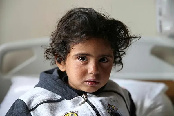 YPG'nin saldırısında yaralanan çocuklar Türkiye'de-5