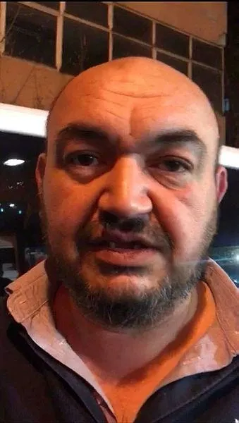 Sarıyer’de UBER sürücüsünü darp edip dişlerini kırdılar-3