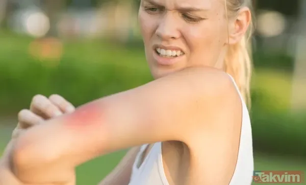 Sinek kovucu doğal yöntemler neler? Sinek ısırığına ne iyi gelir? 1 dakikada sivrisineğe kesin çözüm! - 16