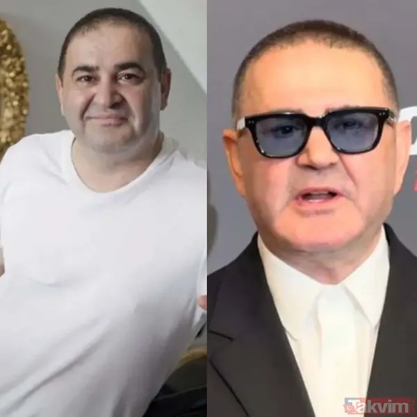 Alişan'dan botoks itirafı! İşte estetik yaptıran erkek ünlüler - 7