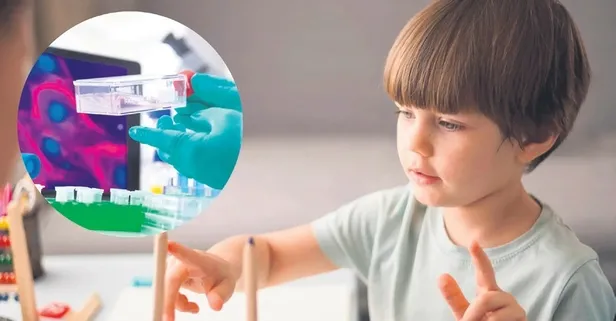 Otizmde kök hücre umudu!