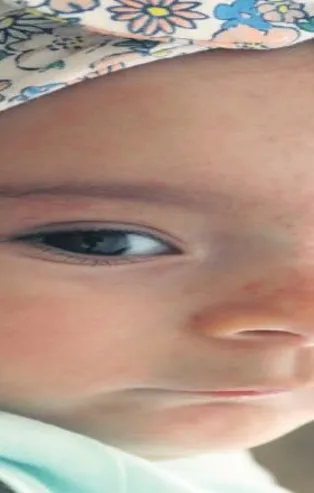 'Sare'ce yaşamak istiyor