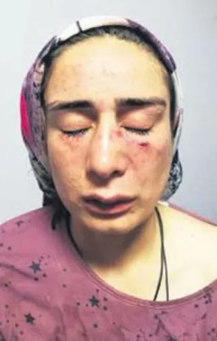 Ellerin kırılsın!