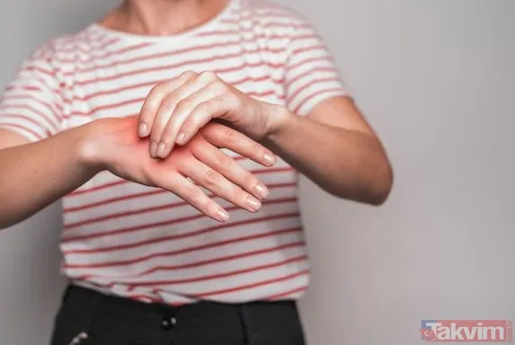 🌞 Ter, Klor, Güneş: Cildi Zorlayan Üçlü Yaz Aylarında En Büyük Tetikleyiciler Arasında Yoğun Terleme Yer Alıyor. Dermatoloji Uzmanı Dr. Aylin Tetik'e Göre,...