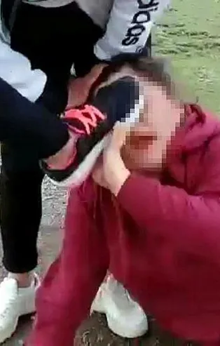 Erzurum'da öfkeli gençlerden 'dedikodu' işkencesi