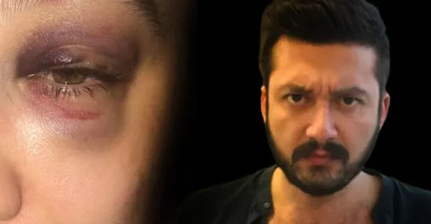 Bakırköy'de dehşeti yaşayan kadın: 1 aydır...
