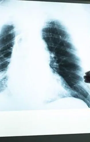 Koronavirüs teşhisinde büyük başarı! Türk mühendis geliştirdi