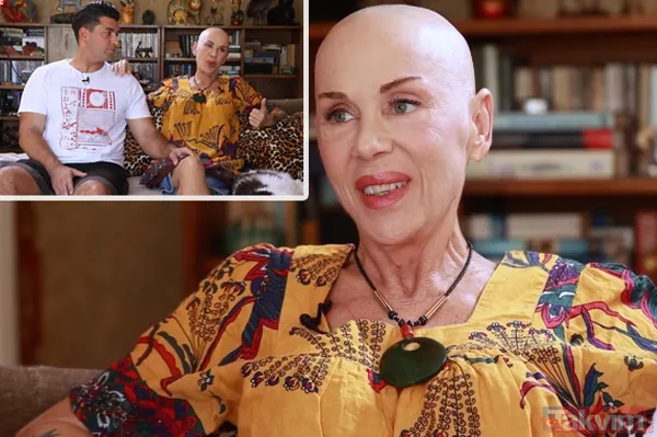 Billur Kalkavan hastalık süreciyle ilgili her detayı anlattı: "İlk duyduğumuzda hüngür hüngür ağladık ama bu durum bana bir öğreti oldu" - 1