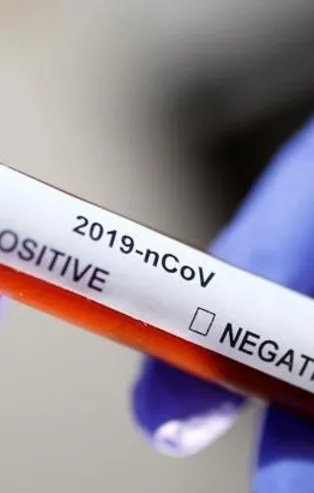 Türkiye'de 9 Nisan koronavirüs (Kovid-19) vaka sayısı kaç oldu? İşte gün gün koronavirüs vaka ve ölüm sayıları