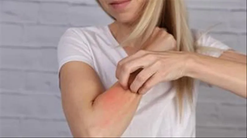 eve-girdiginde-direkt-kasiniyor-sebebini-duyanlar-kulaklarina-inanamayacak-1731617400491.jpg Sebebini duyanlar kulaklarına inanamayacak! Eve girdiğinde direkt kaşınıyor!-4