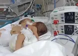 Afrinli yapışık ikizler, Hatay'a getirildi