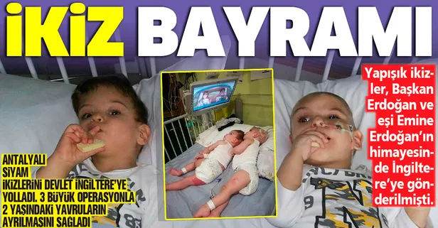 Başkan Erdoğan'ın talimatıyla Londra'ya yollanan siyam ikizleri ameliyatla ayrıldı