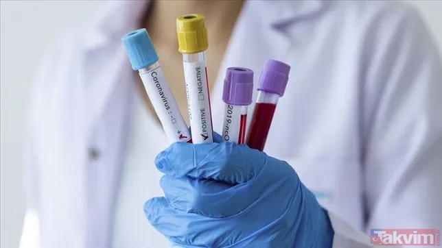 SON DAKİKA: Koronavirüs Bilim Kurulu'nun önerisi ortaya çıktı! İşte okullar ve kafeler için verilen tarih