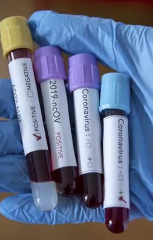 Yeni vaka 918’e düştü