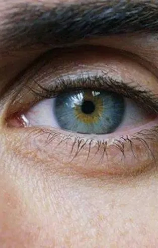 Sarı nokta hastalığı 55 yaşını bekler