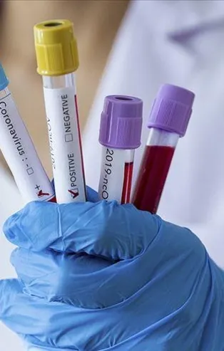 Son dakika: Sağlık Bakanlığı 2 Ekim 2021 koronavirüs vaka, vefat ve aşı tablosunu paylaştı