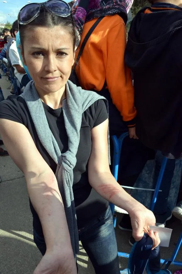 Erdoğan'a sesini duyurmak için ağaca çıktı-2