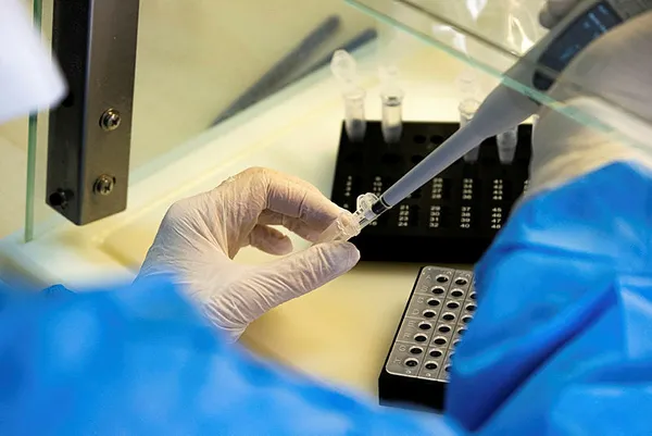 turkiyede-yapilan-arastirma-sinovac-asisinin-bagisikligi-yuzde-99-kuvvetlendirdigi-kanitlandi-1617651714268.jpg Türkiye'de yapılan araştırma... Sinovac aşısının bağışıklığı yüzde 99 kuvvetlendirdiği kanıtlandı-5