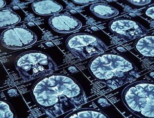 Bir haftada yüzde 40 daha zeki olmak mümkün!