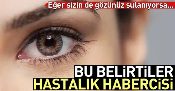 Gozlerdeki Bu 6 Belirtiye Dikkat Saglik Son Dakika Haberler