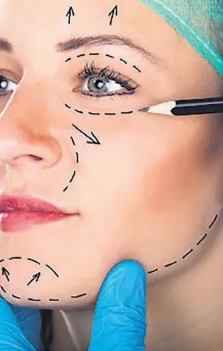 Estetik boşanma sebebi (Yurttan ve dünyadan haberler)