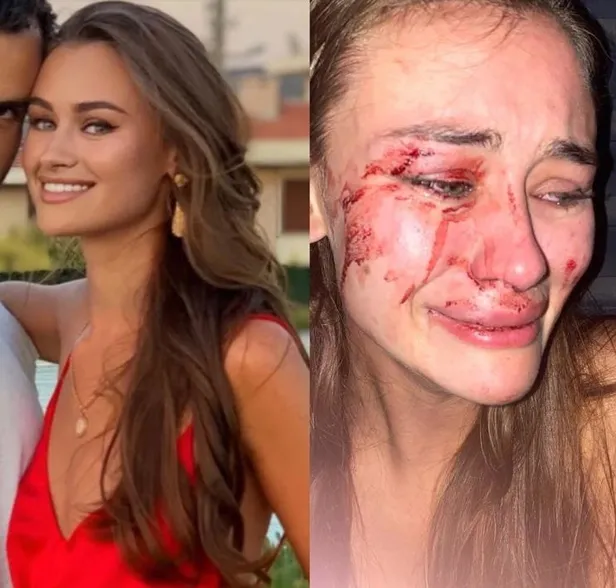 Son dakika: Dünyaca ünlü top model Daria Kyryliuk'a plajda dayak-1