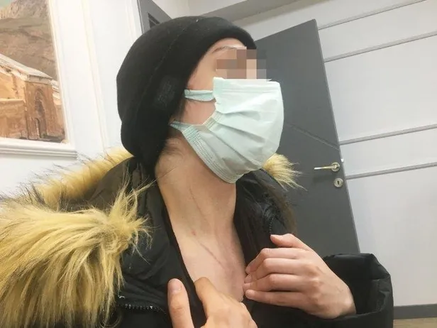 Rezidansta işkence gören Demet A'nın bilirkişi raporu ortaya çıktı! Sigara yanığı, boyun çevresinde ve yüzünde bıçak çizikleri...-6