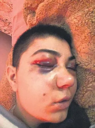 Yeni nişanlanan Zehra Meraklı, Beyoğlu'nda yediği dayakla felç kaldı-1