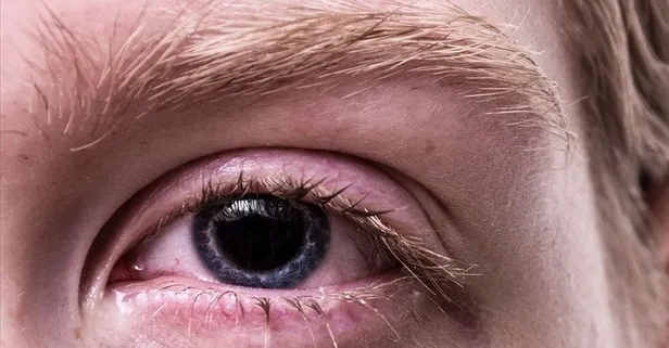 Keskin gözler için 40’lı yaşlardan sonra mutlaka tüketilmesi gereken 4 besin