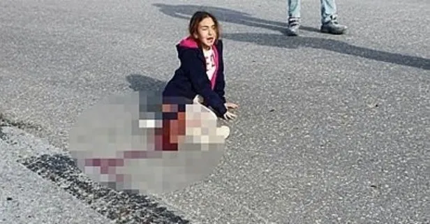 Son dakika: Mahra Melin Pınar öldü mü? Mahra Melin Pınar sağlık durumu nasıl? Köpeklerden kaçarken kamyonun altında kalmıştı