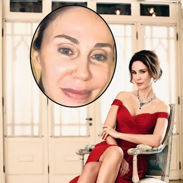 Yüzde yüz estetik
