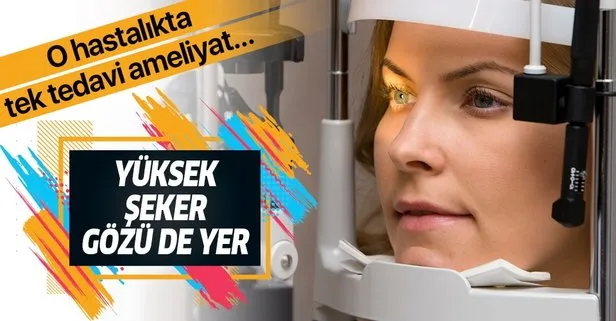Yüksek şeker katarakt yapar