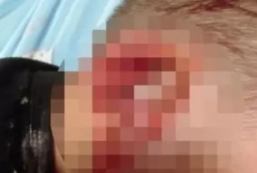 Oğlum korkudan dışarıya çıkamıyor