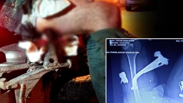 İzmir'de akılalmaz olay! Hastaneye bu halde getirildi-1