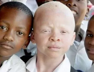 BM açıkladı! Her 11 saniyede bir bebek...