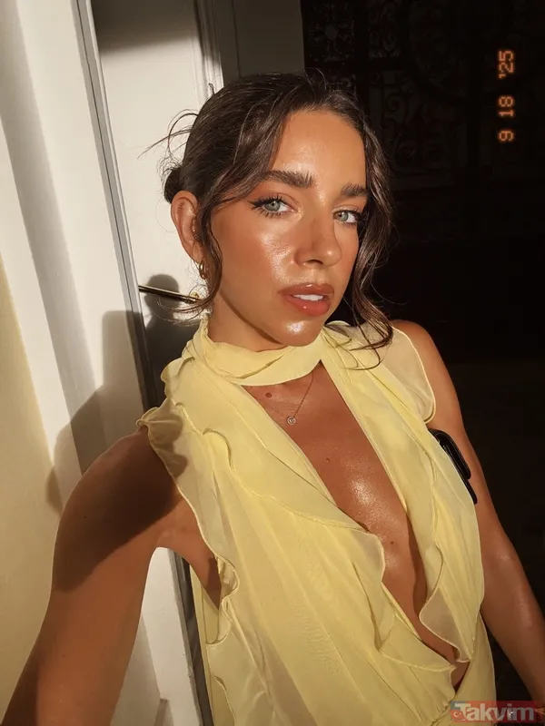 Elvin Levinler ağzının içine masaj yaptırdığı anları takipçileriyle paylaştı - 6