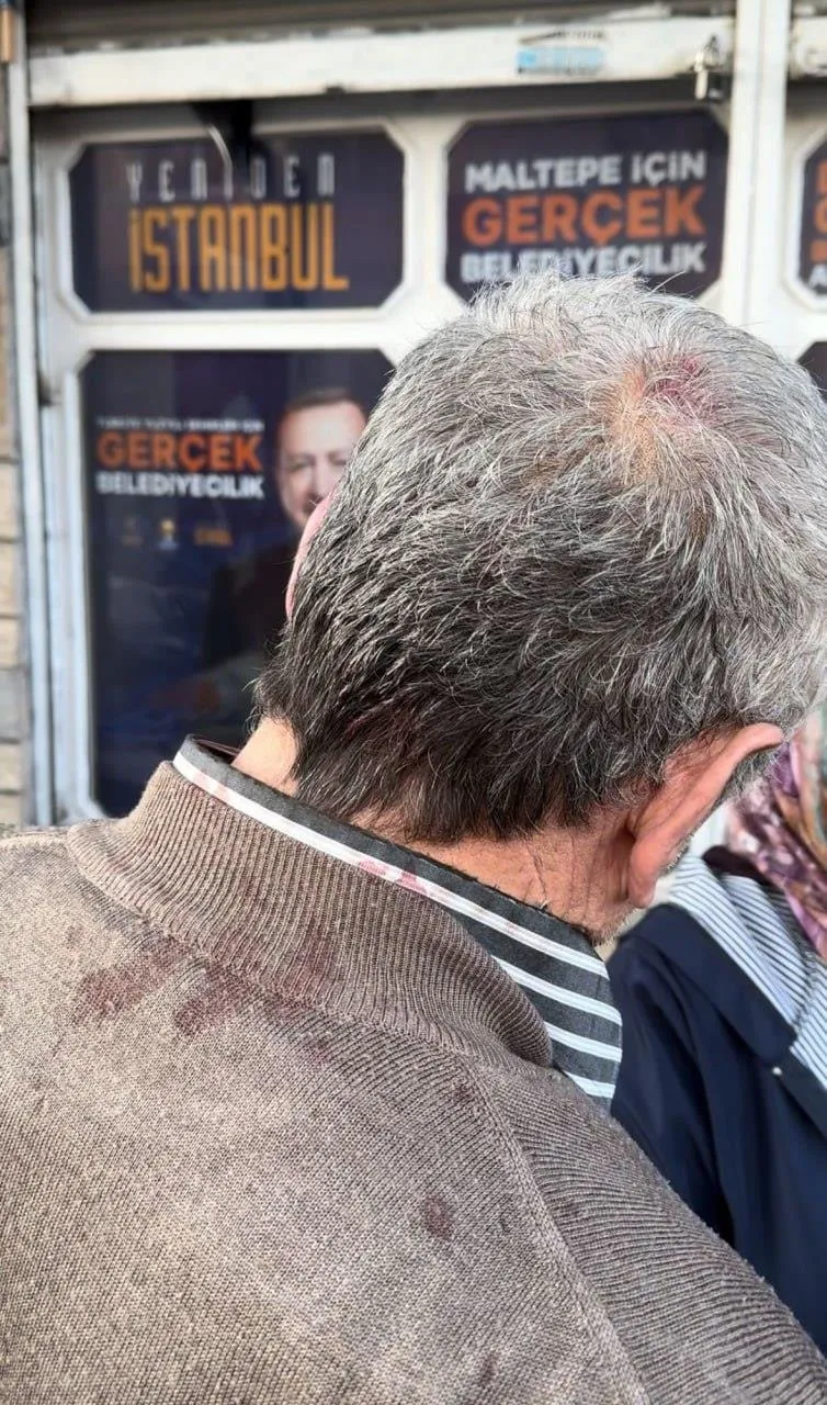 istanbul-maltepede-chpli-bir-grup-72-yasindaki-ramazan-amcaya-ve-yaninda-secim-calismasi-yapan-kadinlara-saldi-1711228655014.jpeg İstanbul, Maltepe’de CHP’li bir grup 72 yaşındaki Ramazan amcaya ve yanında seçim çalışması yapan kadınlara saldırdı-2