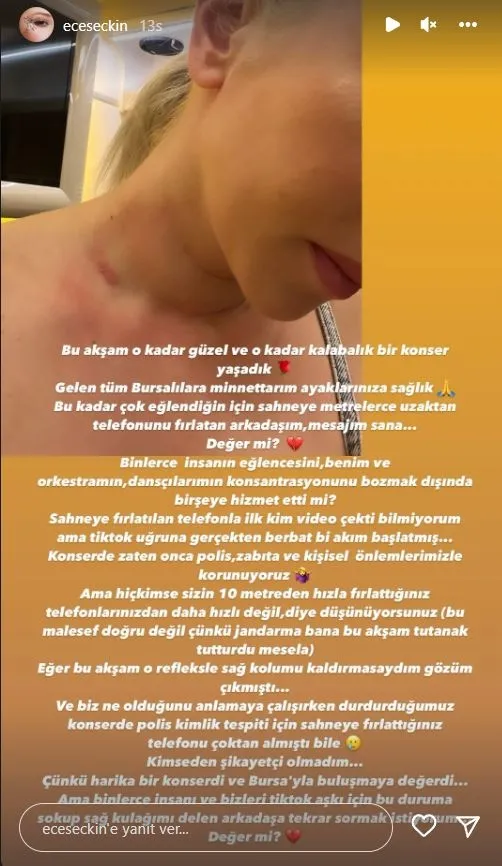 ece-seckine-sahnede-buyuk-sok-konser-sirasinda-firlatilan-telefon-sarkiciya-isabet-etti-buna-deger-mi-1659279624859.jpg Ece Seçkin’e sahnede büyük şok! Konser sırasında fırlatılan telefon şarkıcıya isabet etti! “Buna değer mi?”-7
