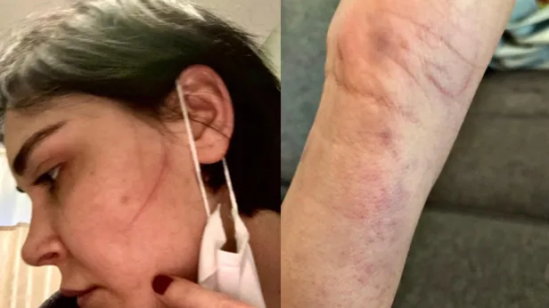 Sevcan Yaşar'a mahrem görüntü şoku! Sermiyan Midyat ile Sevcan Yaşar arasında neler oluyor? "Dövüp çıplak videomu çekti..."-5