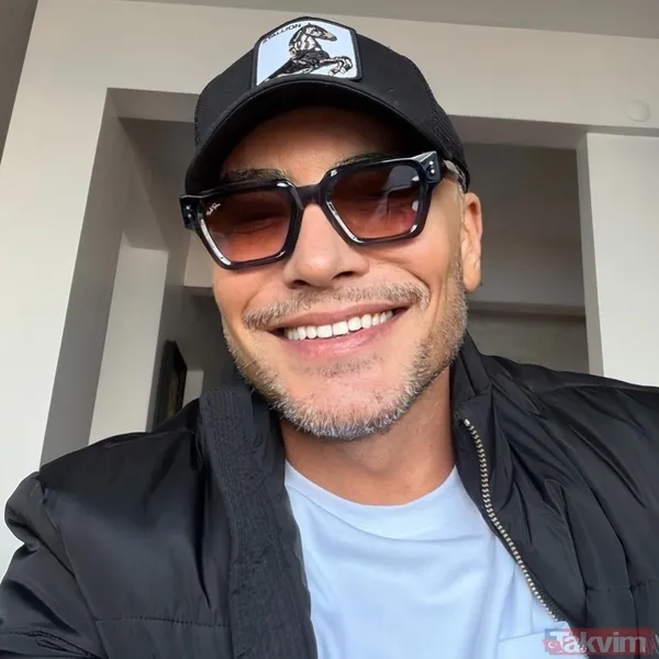 Cenk Eren’den estetik açıklaması: Aynalarla arası bozulunca soluğu doktorda aldı! - 3