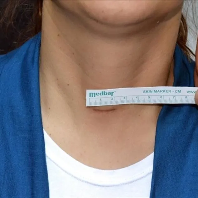 Fazla şeker tiroidi çeker