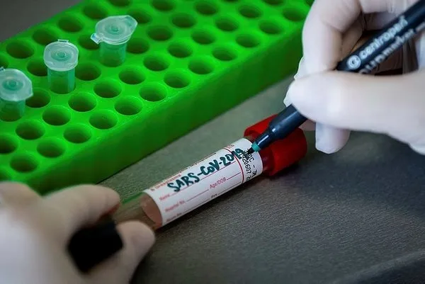 Bilim insanları ilk kez açıkladı! Koronavirüsün altında yatan neden! Yeni bir tehdit ortaya çıktı!-3