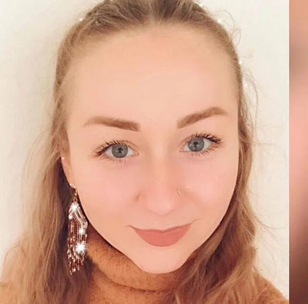 Eşi falçatayla saldırdı Ukraynalı Hanna Butym'un yüzünün bir kısmı felç kaldı!-5