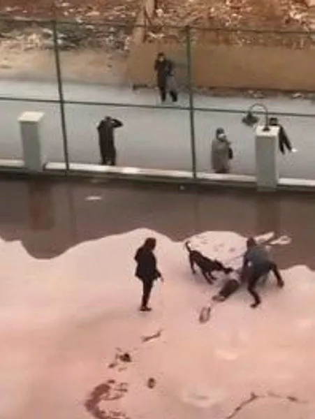 gaziantepte-iki-pitbullun-yuzunu-parcaladigi-minik-asiye-antalyaya-sevk-edildi-1640385158914.jpg Gaziantep'te iki "pitbull"un yüzünü parçaladığı minik Asiye Antalya'ya sevk edildi-3