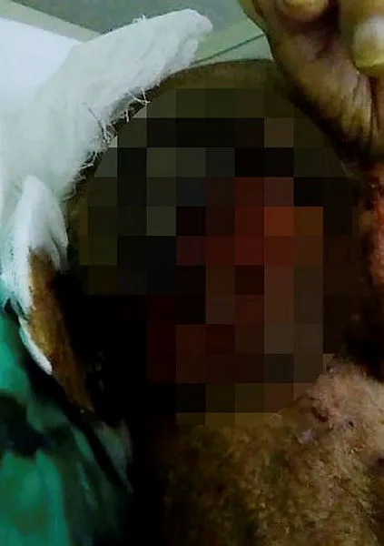 Bakımevindeki görüntüler dehşete düşürdü! Yaşlı adamın kafasında kurtçuklar...-2
