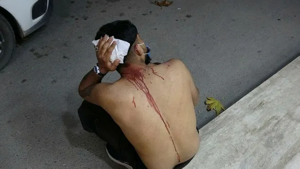 SON DAKİKA: Bursa'da kan donduran olay: Başına çivili sopa ile vurdular ambulansta linç etmeye çalıştılar-4